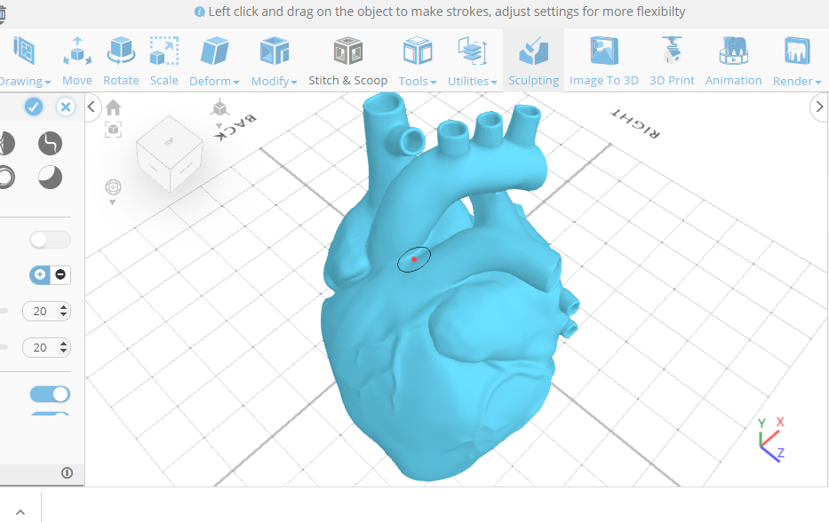 3D modeling in medicine