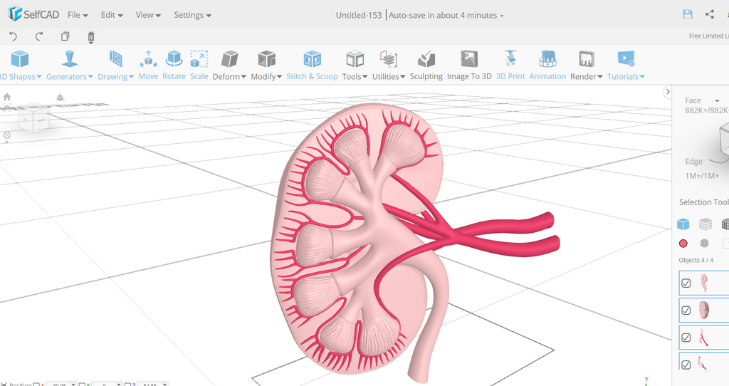 3D printed kidney