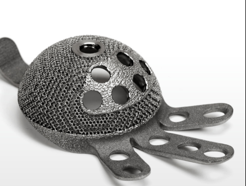 A 3D printed titanium orthopedic medical implant displaying a highly porous, mesh-like trabecular surface designed to promote bone integration