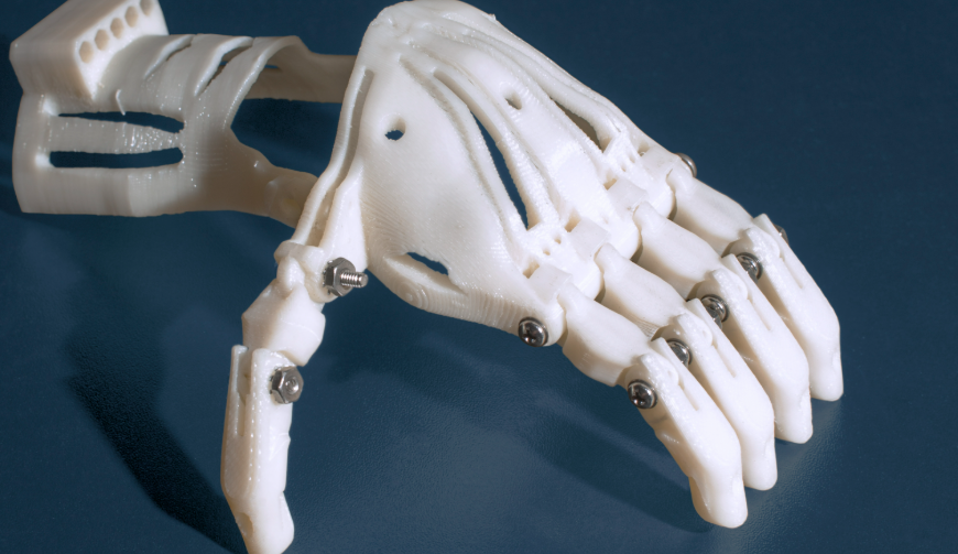 3D-Printed Prosthetics