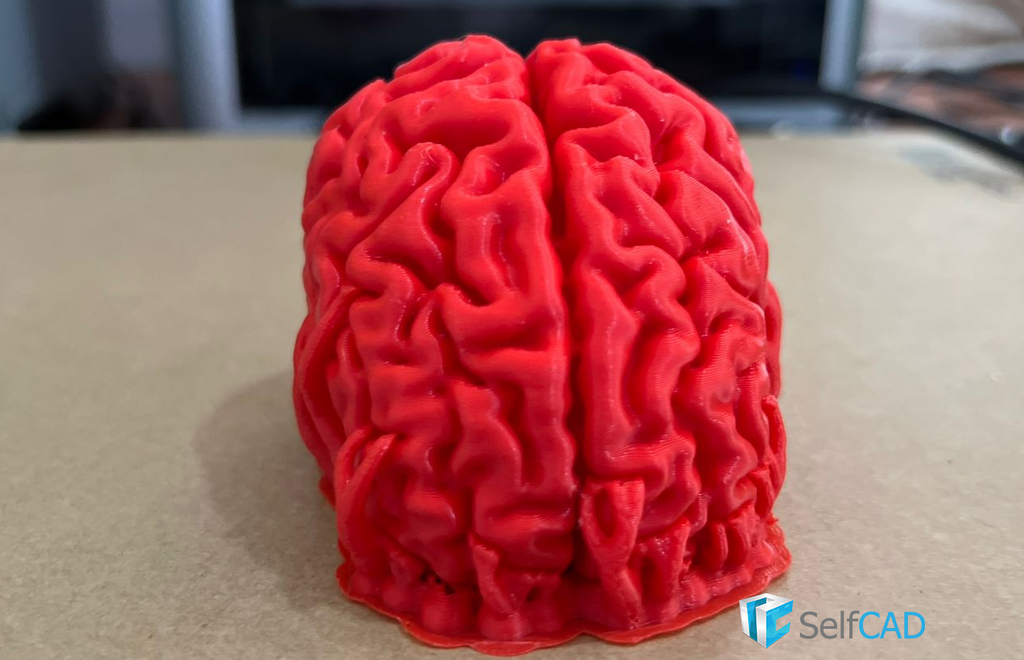 3D model of the brain